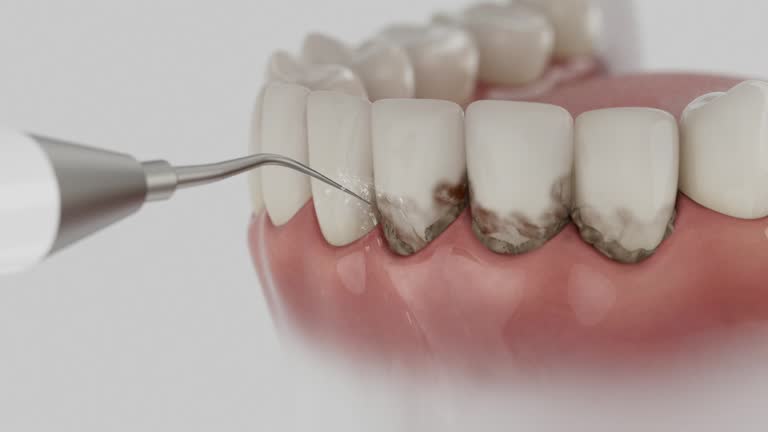 Reliable Dental Implants contractor in Glade Spring, VA by Smile Center Dentistry